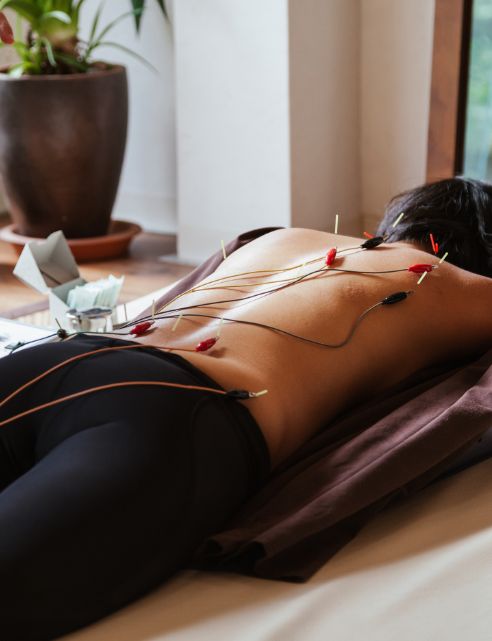 Acupuncture with electrical stimulation session in Japanese medical study